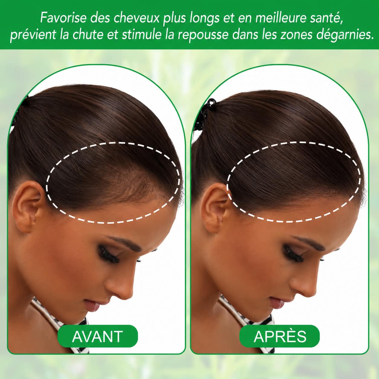Huile Essentielle Capillaire de Romarin 100 % Pure ALIVER