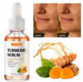 Sérum Visage & Corps & Cheveux au Curcuma – Éclat du Teint